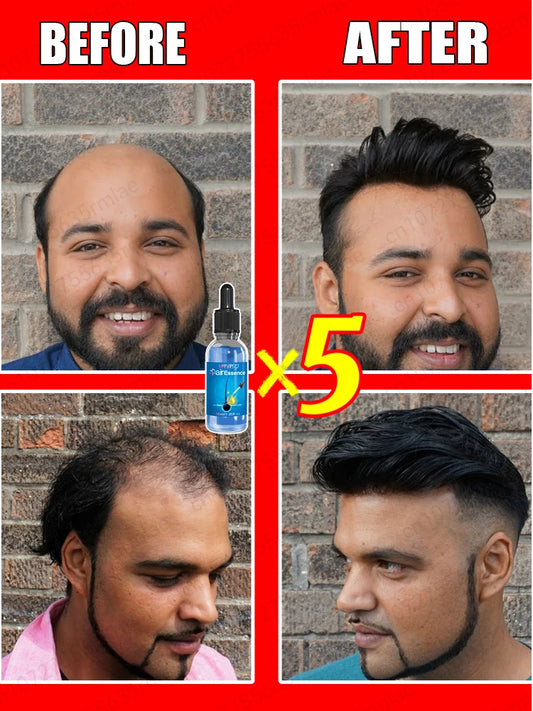 Hair Growth Essential Oil 30ml