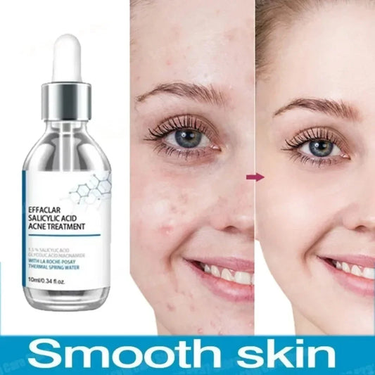 Salicylic Acid Pore Serum