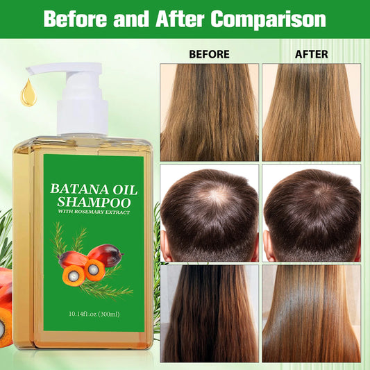 Batana Oil Hair Restore Set