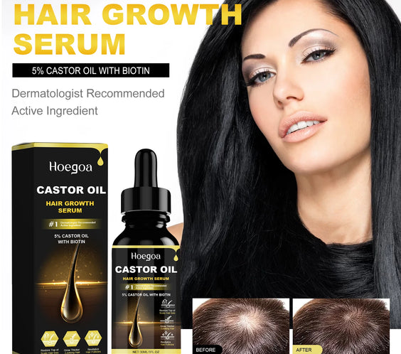 HOEGOA Castor Oil Hair Thickener 30ml bottle with precision dropper and label noting natural plant ingredients