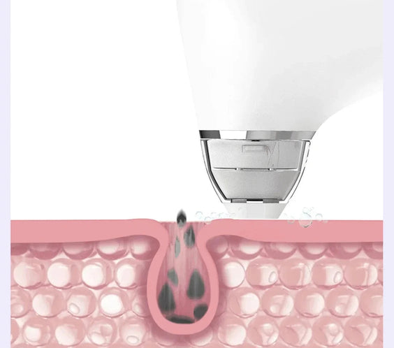 Professional Pore Extractor & Cleanser	Minimizes Pores & Smooths Skin Texture.