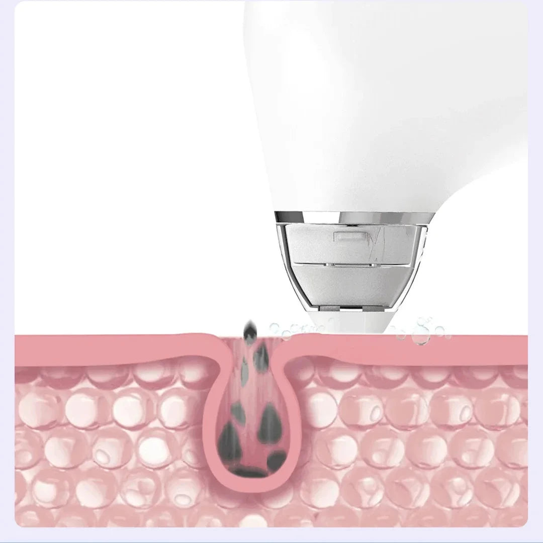 Professional Pore Extractor & Cleanser	Minimizes Pores & Smooths Skin Texture.