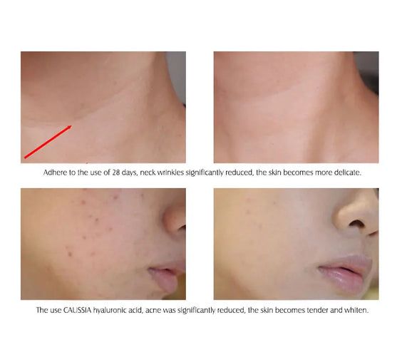 Hyaluronic Acid Serum 10pcs