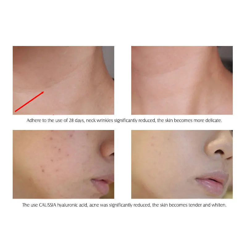 Hyaluronic Acid Serum 10pcs - Beauty Bae