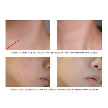 Hyaluronic Acid Serum 10pcs - Beauty Bae