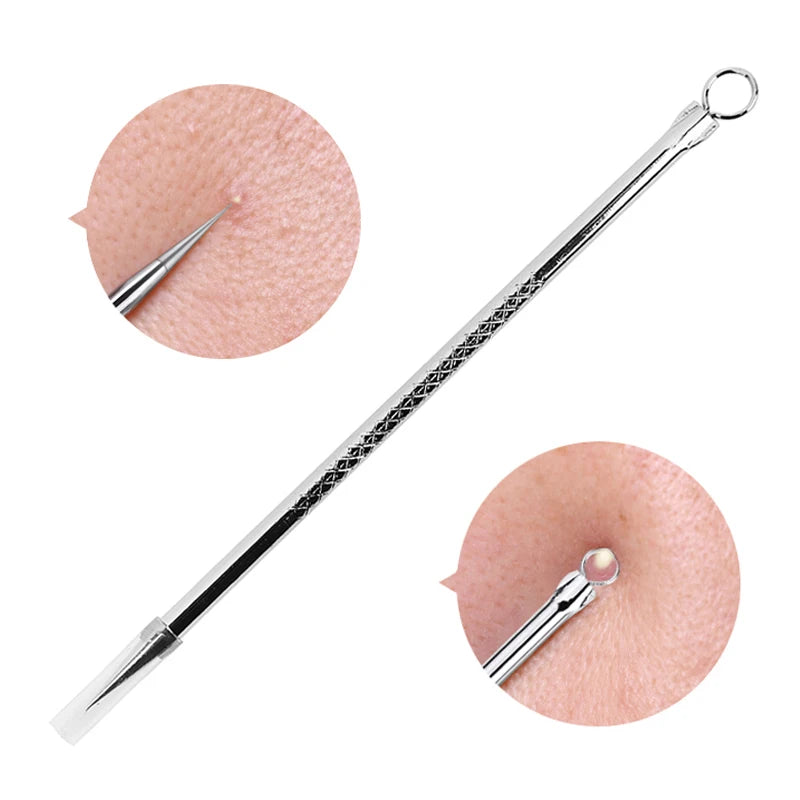 Stainless blackhead extractor with 6mm needle tip and circular loop stainless steel compact tool