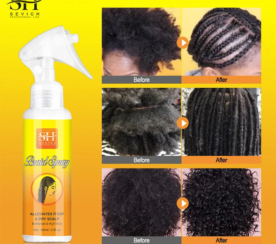 Anti-Itch Scalp Spray 100ml