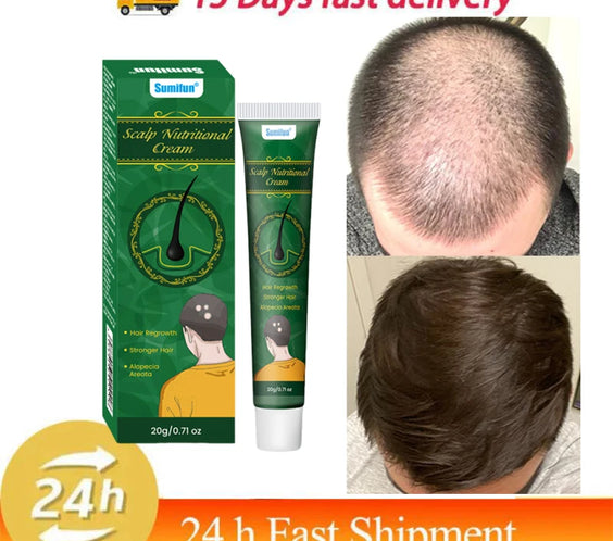 5 Days Ginger Scalp Cream