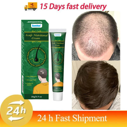 5 Days Ginger Scalp Cream - Beauty Bae