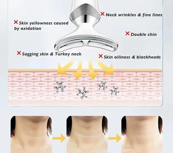 Neck Facial Lift Device