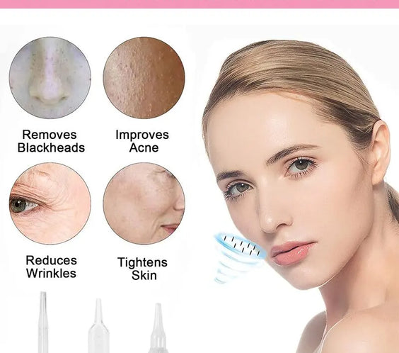 Diamond Microdermabrasion Kit