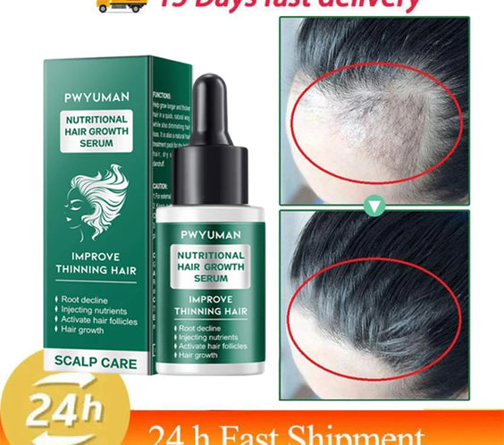 5 Days Ginger Scalp Cream