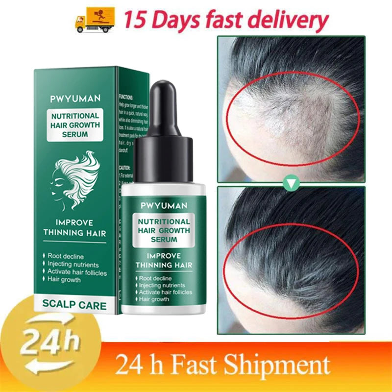 5 Days Ginger Scalp Cream