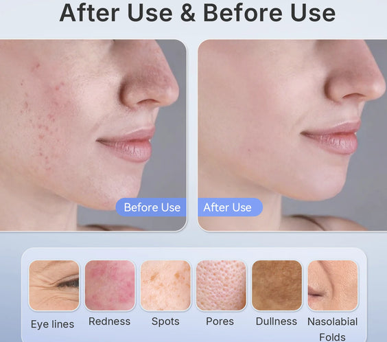 NIR Red Light Facial Mask