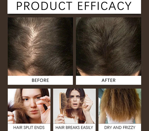 Biotin Hair Growth Spray 30ml