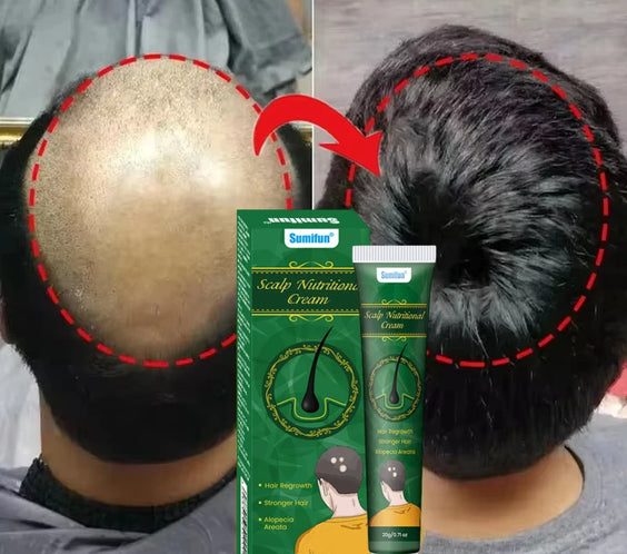 5 Days Ginger Scalp Cream