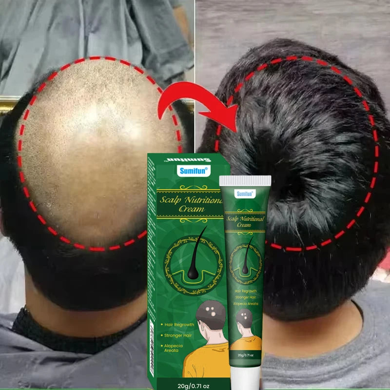 5 Days Ginger Scalp Cream