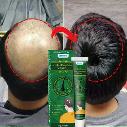 5 Days Ginger Scalp Cream - Beauty Bae