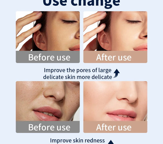 7-Color LED Anti-Aging Mask