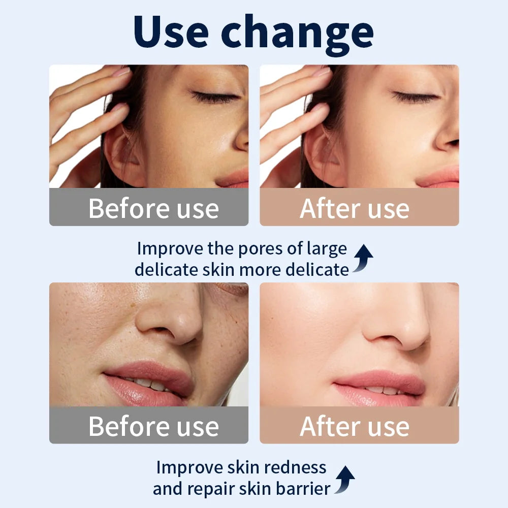 7-Color LED Anti-Aging Mask - Beauty Bae