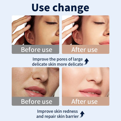 7-Color LED Anti-Aging Mask - Beauty Bae