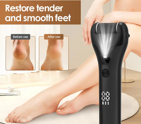 Silky Feet Pedicure Tool – Luxury Callus Remover & Spa-Grade Foot Care for Silky Smooth Skin.