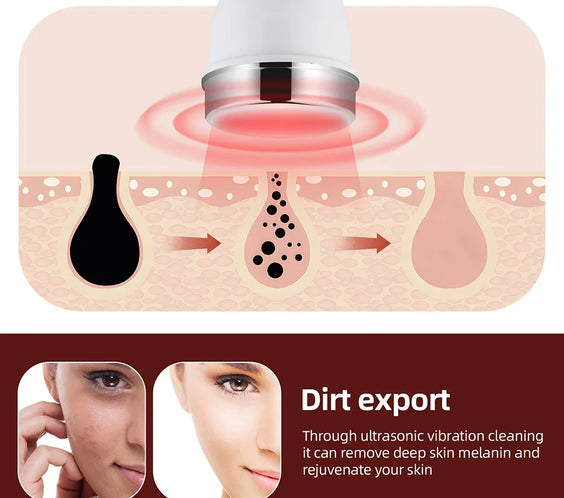 1MHz Ultrasonic Face & Eye