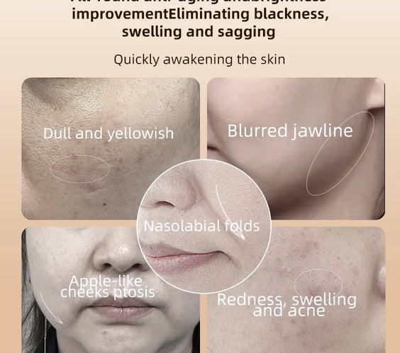 EMS Heated Roller Massager