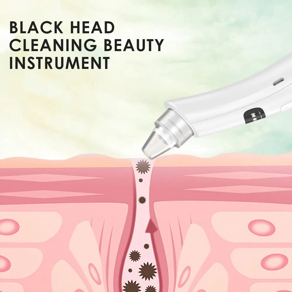 Face Vacuum Blackhead Remover