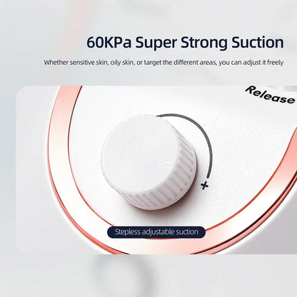 Diamond Microdermabrasion - Beauty Bae