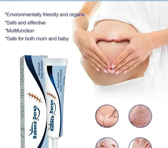 Stretch Mark Repair Cream