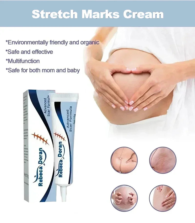 Stretch Mark Repair Cream