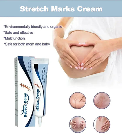 Stretch Mark Repair Cream - Beauty Bae
