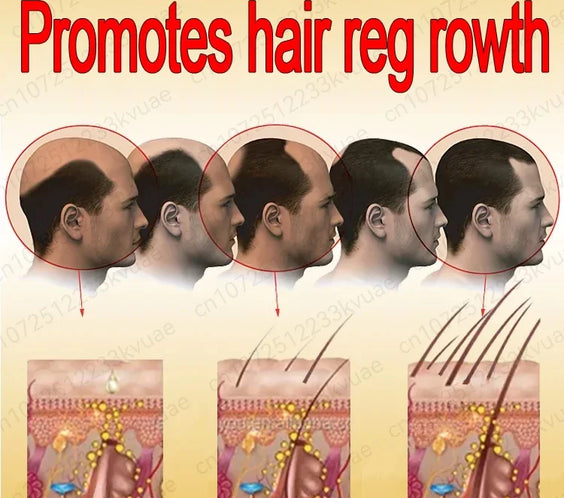 30ml Hair Growth Scalp Oil