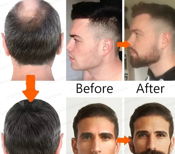 Beard Growth Essence 30ml