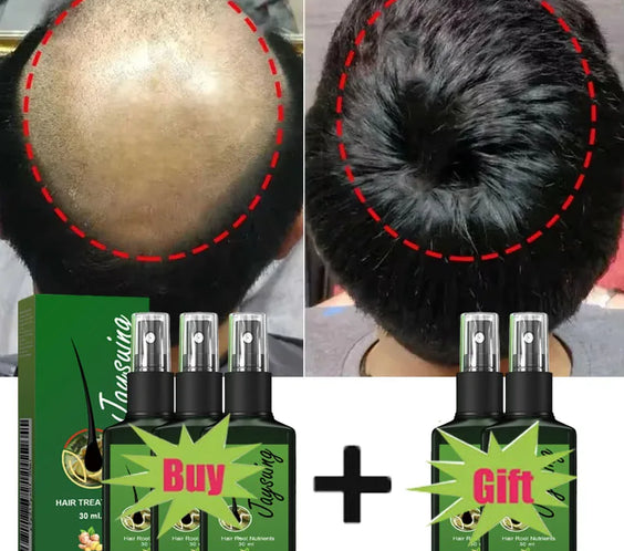 Ginger Scalp Growth Serum