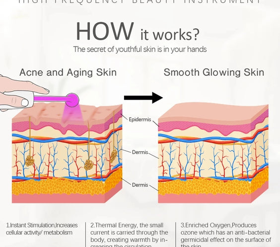 HF Facial Wand 4 Glass Tubes