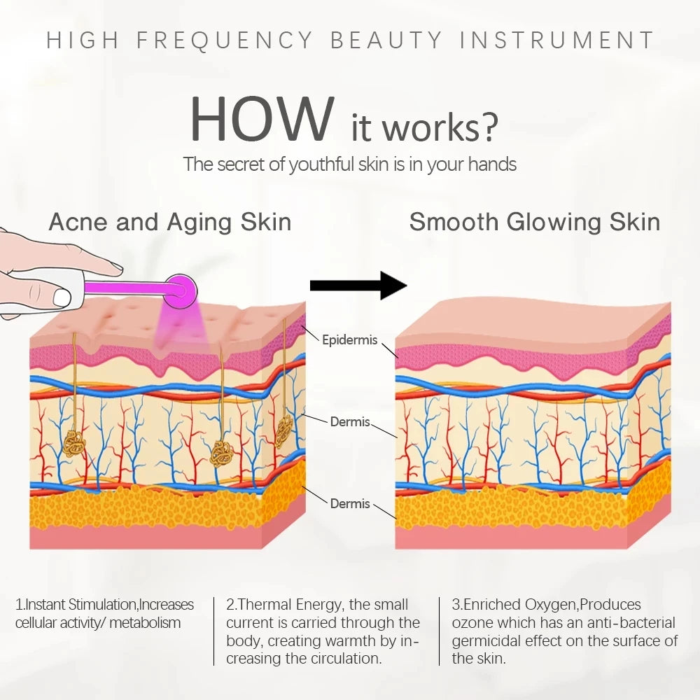 HF Facial Wand 4 Glass Tubes - Beauty Bae