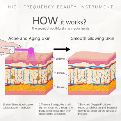 HF Facial Wand 4 Glass Tubes - Beauty Bae