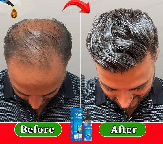 Hair Growth Essential Oil 30ml bottle labeled with Production License 2021040878 3 year shelf life Origin Mainland China