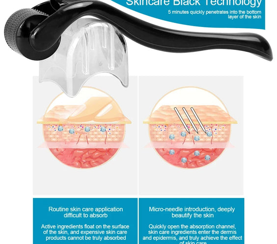 Titanium 540 Beard Roller