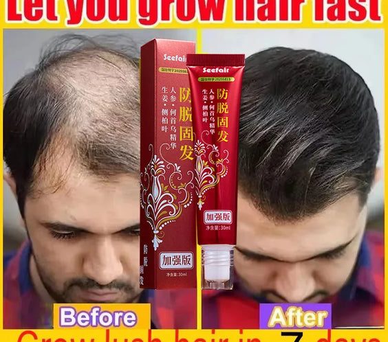 Fast Hair Regrowth Cream