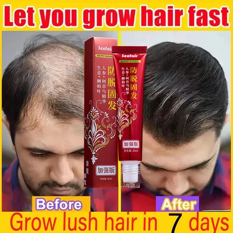 Fast Hair Regrowth Cream