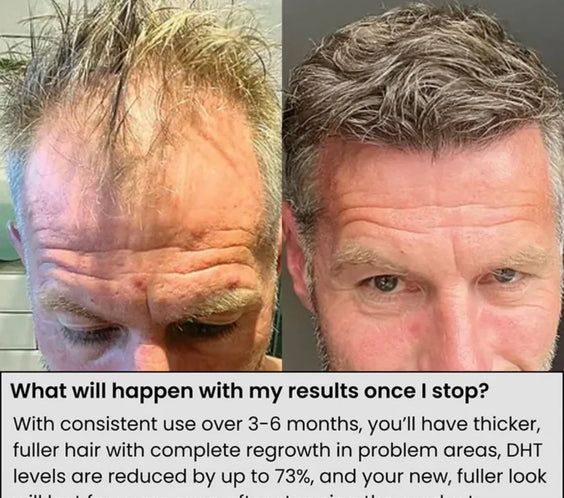 Scalp Nourishing Serum