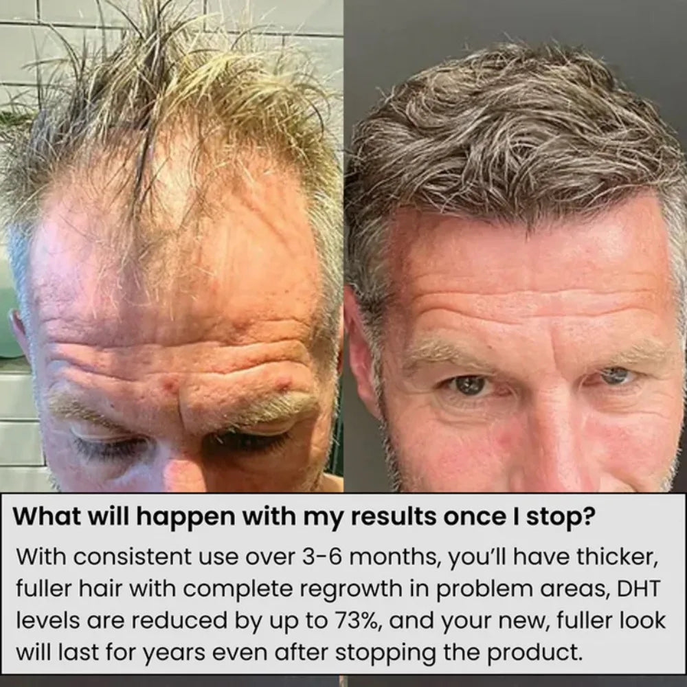 Scalp Nourishing Serum