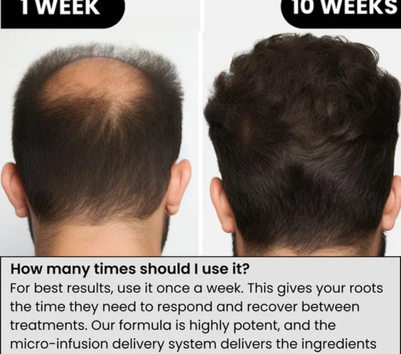 Scalp Nourishing Serum