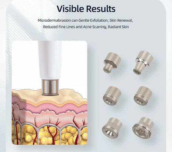 Diamond Microdermabrasion