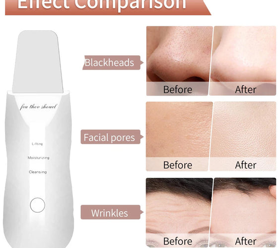 Ultrasonic Metal Skin Scraper