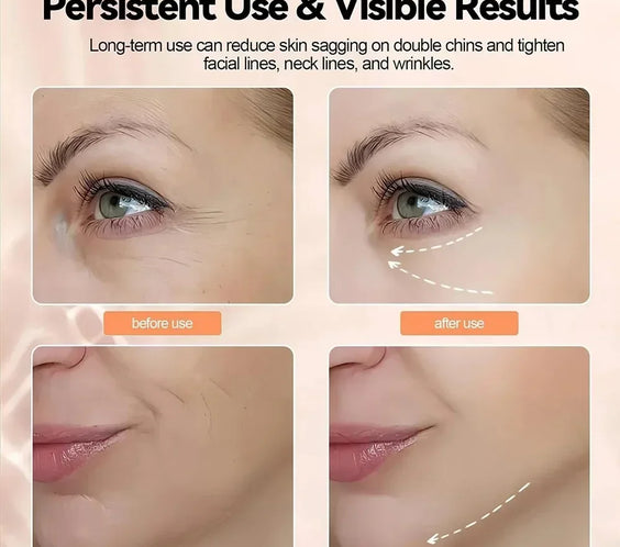 Neck Facial Lift Device