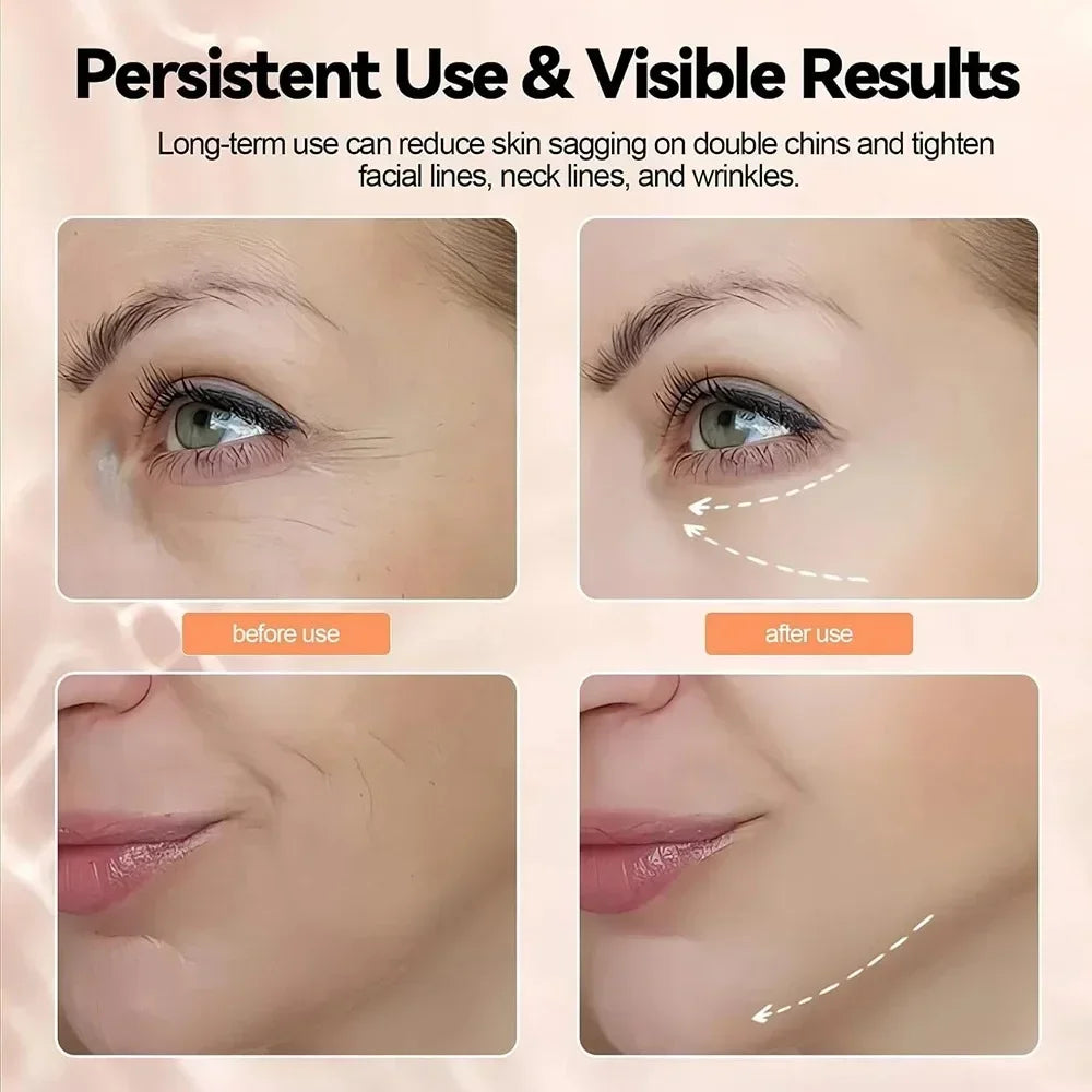 Neck Facial Lift Device